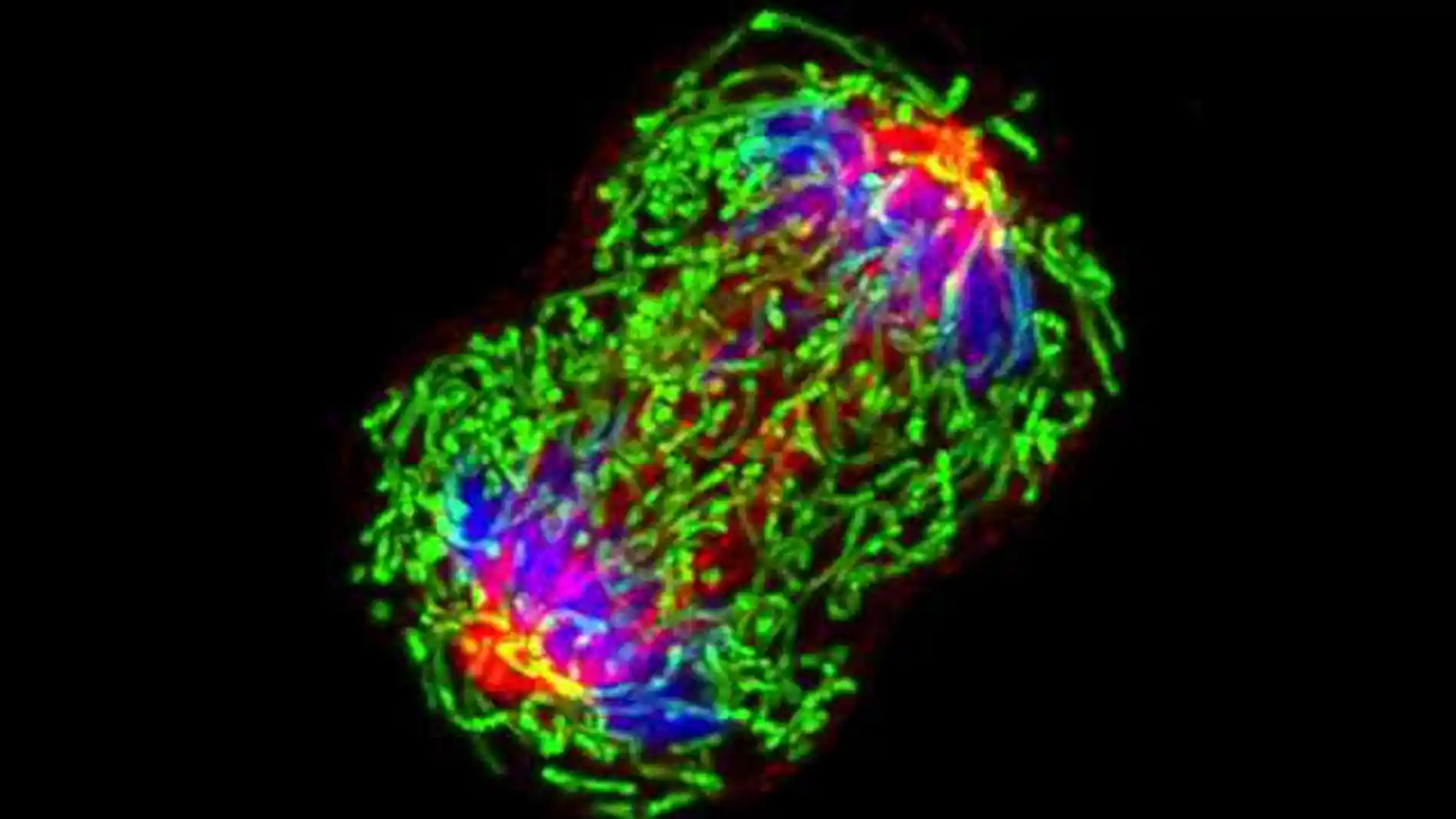 Un estudio revela cómo los peligros del cáncer de mama y la diabetes se combinan