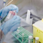 Una enfermera sostiene una de las pruebas de análisis para la viruela del mono, en el Hospital Ramón y Cajal