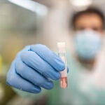Procesamiento de muestras para PCR de Monkeypox