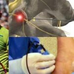 Así será el nuevo tratamiento de Nadal