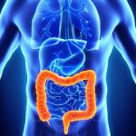 El cáncer colorrectal es el tumor maligno más frecuente en España y el segundo en tasa de mortalidad 