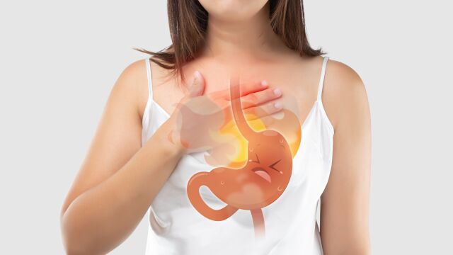 Enfermedad por reflujo gastroesofágico