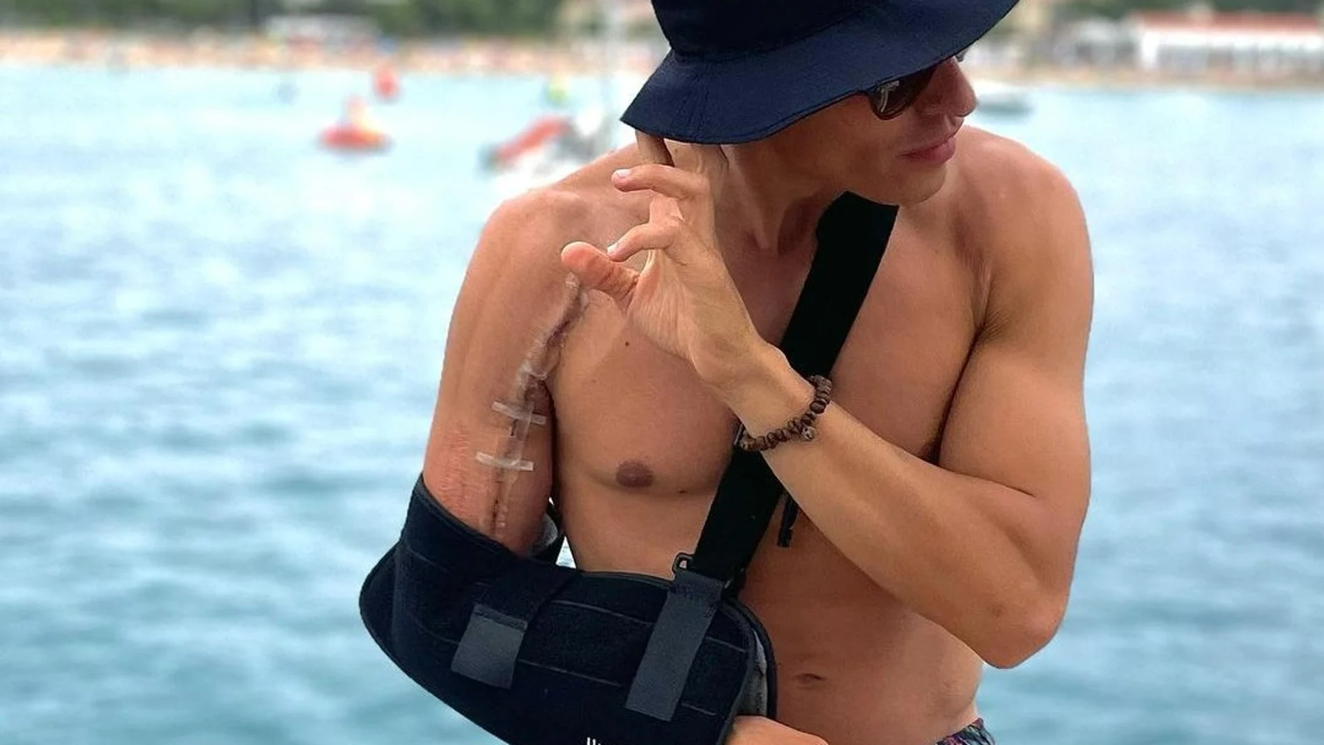 Marc Márquez está de vacaciones mientras se recupera de la última operación