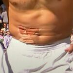 El vendaje abdominal de Rafa Nadal