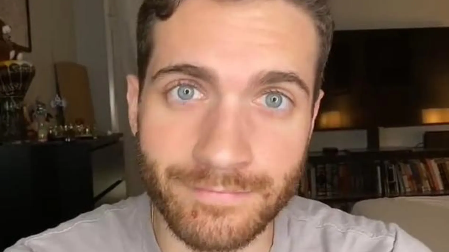 El actor Matt Ford confiesa que padece viruela del mono