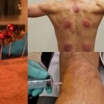 Los tratamientos más extraños del deporte