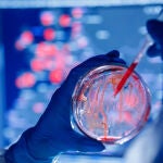 Para Europa, las tres principales amenazas para la salud son los patógenos, los riesgos químicos, biológicos, radiológicos y nucleares y los derivados de la resistencia a los antimicrobianos