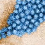 Los microbios intestinales pueden reducir o aumentar la gravedad de la infección por norovirus en función del lugar a lo largo del intestino donde se asiente el virus