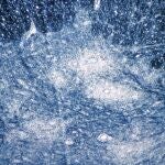 Imagen de microscopio de 1964 en la que se muestra el daño del virus de la polio en el tejido de la médula espinal