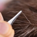 Las canas nacen debido a un proceso natural que produce un cambio en la producción de la melanina, que es el pigmento que da color al cabello | Fuente: Dreamstime