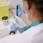 Una enfermera prepara una PCR para el análisis de la viruela del mono
