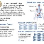 Mieloma m&uacute;ltiple