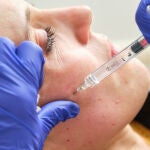 Una mujer se somete a una mesoterapia facial con ácido hialurónico