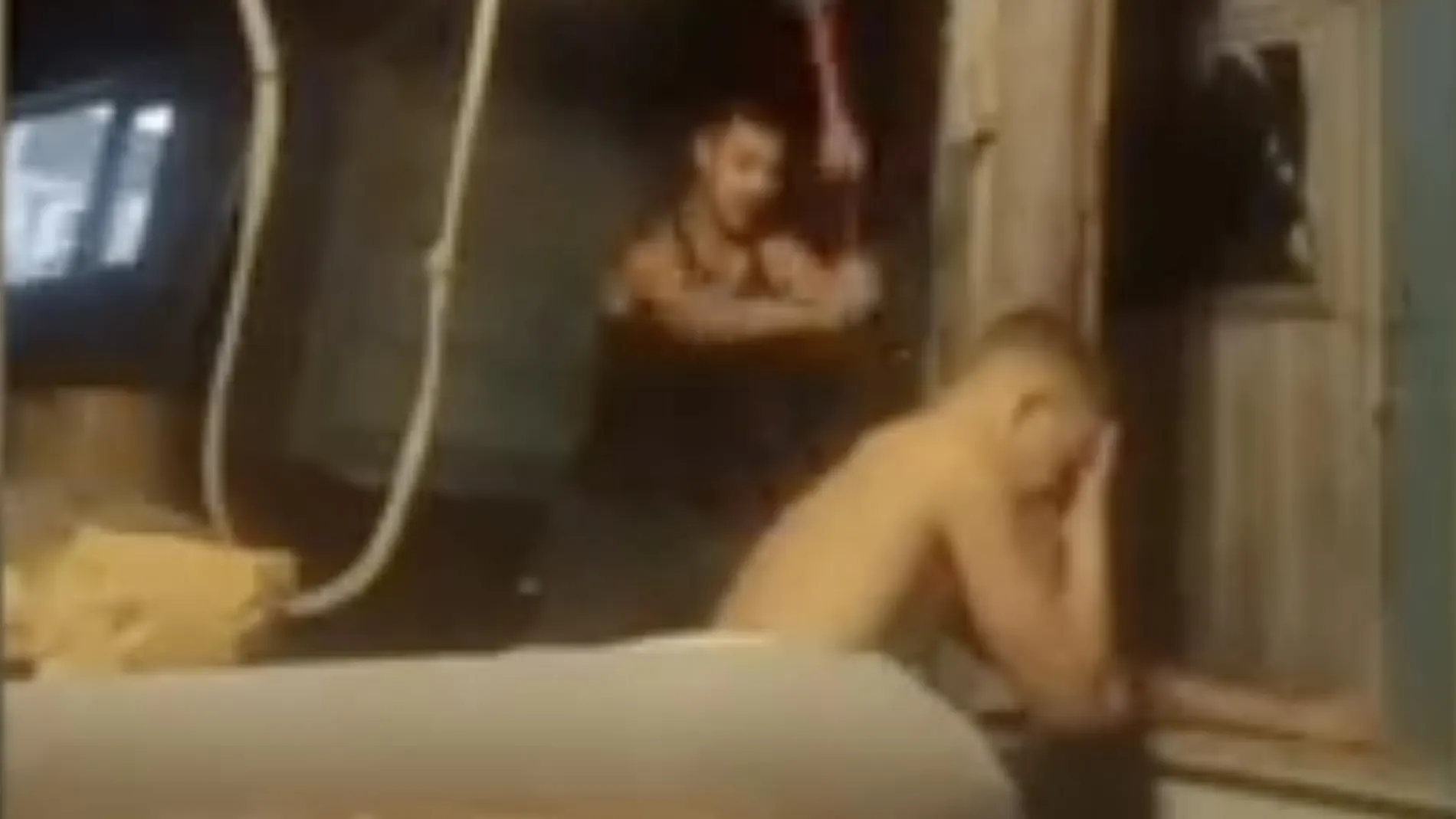 El vídeo de un joven ruso rompiéndole el brazo a su amigo, quien le pidió que con un martillo se lo fracturara, se hizo viral en las redes
