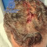 Un hombre herido tras ser atracado para quitarle el reloj
