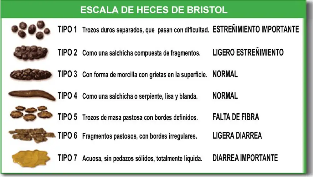 Escala de heces de Bristol. Fuente: De Cabot Health, Bristol Stool Chart