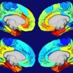 Las áreas rojas y naranjas de estos mapas de calor de cerebros humanos muestran dónde está más activo el gen APOE (dos imágenes cerebrales superiores) y dónde se concentran los ovillos de la proteína tau (dos imágenes cerebrales inferiores).