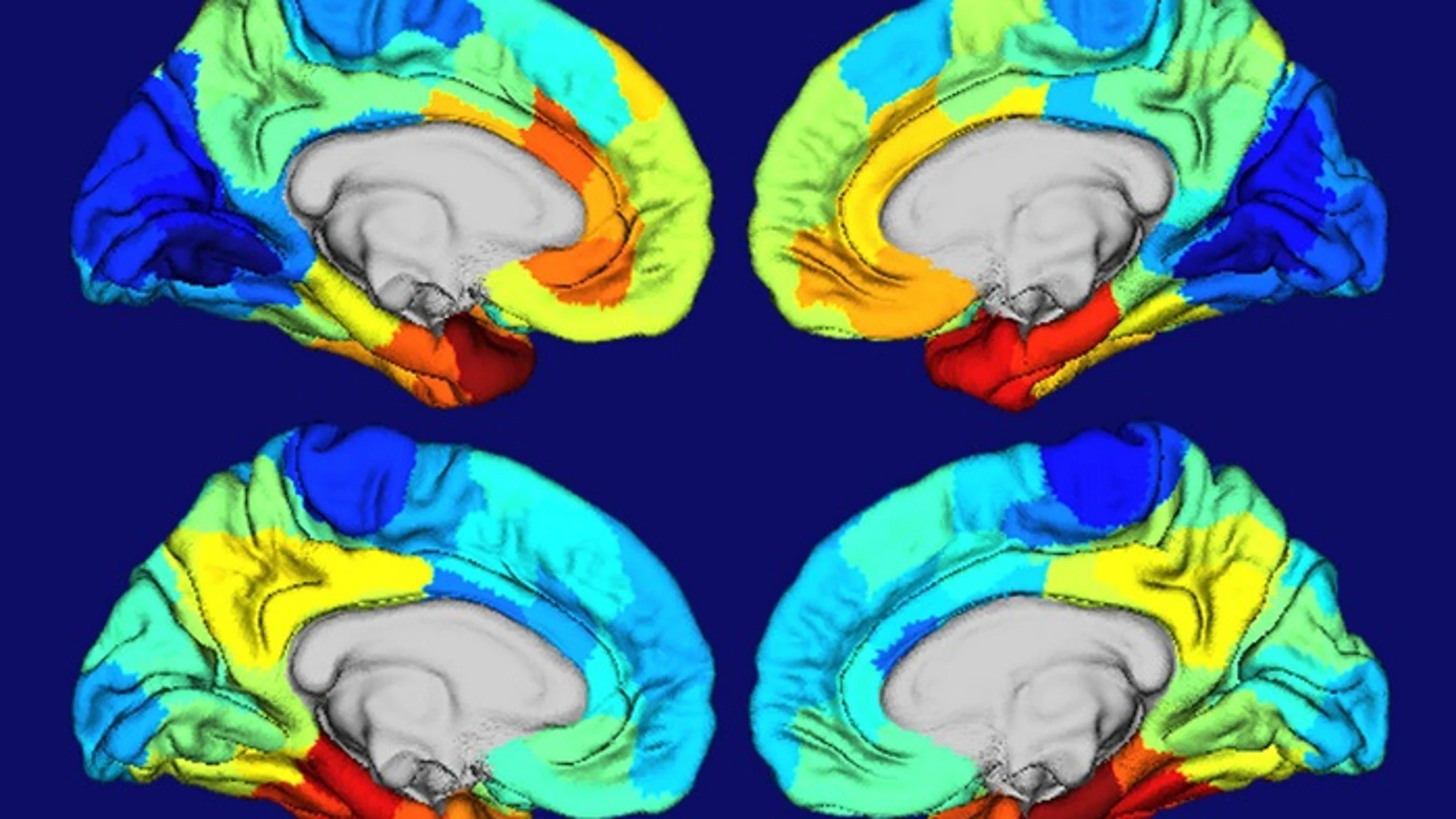 Las áreas rojas y naranjas de estos mapas de calor de cerebros humanos muestran dónde está más activo el gen APOE (dos imágenes cerebrales superiores) y dónde se concentran los ovillos de la proteína tau (dos imágenes cerebrales inferiores).