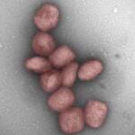 Partículas del virus de la viruela del mono teñidas de rojo