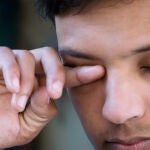 No se debe frotar el ojo nunca aunque haya picor