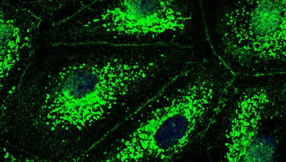 Imagen de microscopio de fluorescencia de células de los vasos sanguíneos pulmonares.CHARITÉ | LASTI ERFINANDA22/12/2022