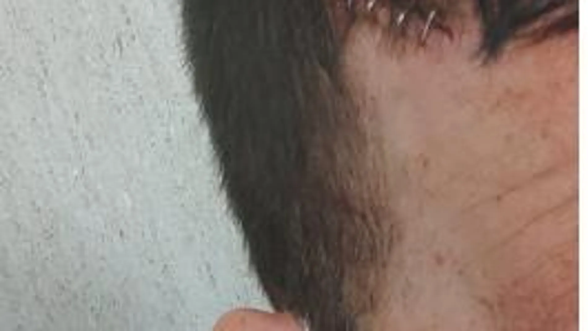 Uno de los agentes recibió una herida de cuchillo en la cabeza (JUPOL)