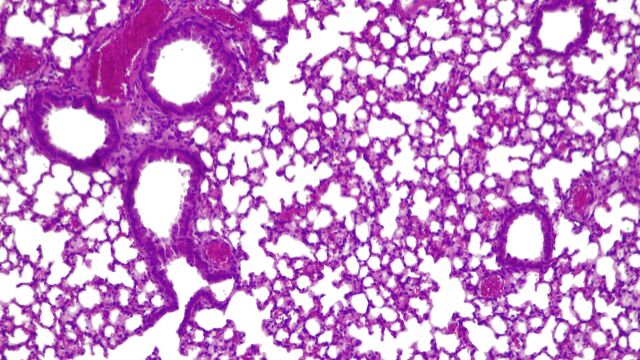 La terapia abre orificios en las paredes celulares y por lo que entran los antibióticos