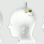 El proyecto Neuralink de Elon Musk pretende comunicar el cerebro humano con un ordenador a través de un chip intracraneal