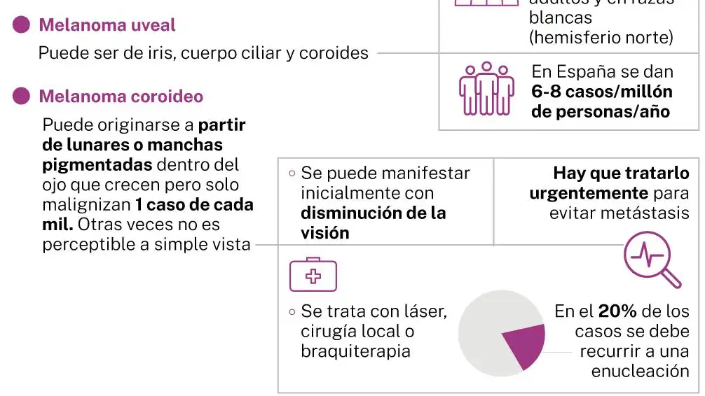Cáncer de ojos