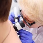 Linfoma cutáneo. Prevención en el dermatólogo