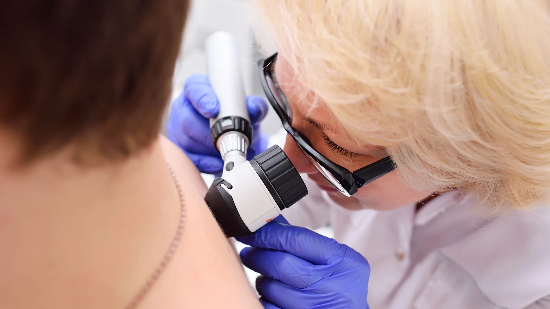 Linfoma cutáneo. Prevención en el dermatólogo