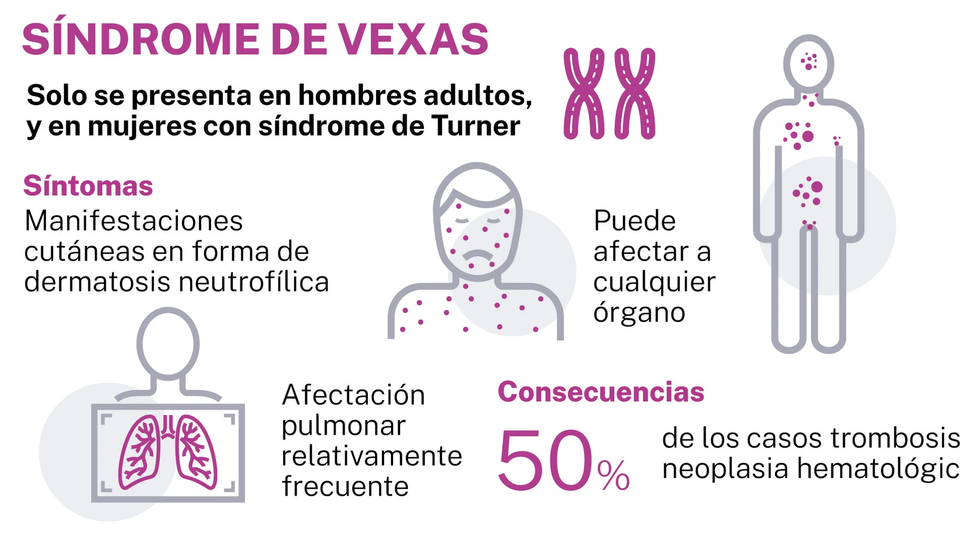 Síndrome de Vexas. Infografía