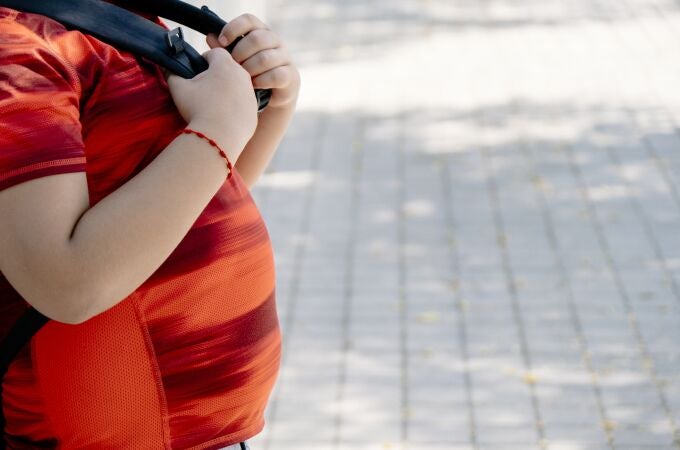 Obesidad infantil. 