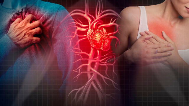 Infartos en hombres y mujeres
