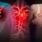 Infartos en hombres y mujeres