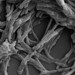 Bacteria Mycobacterium smegmatis, de la cual se obtiene esta enzima