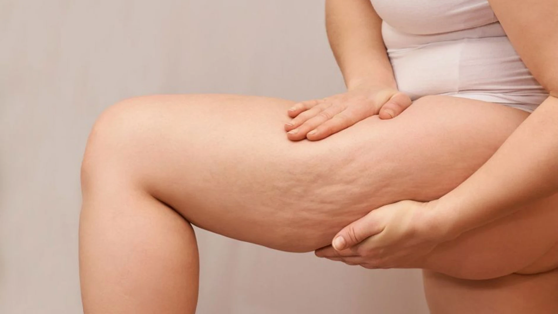 Los 7 mejores productos para eliminar la celulitis