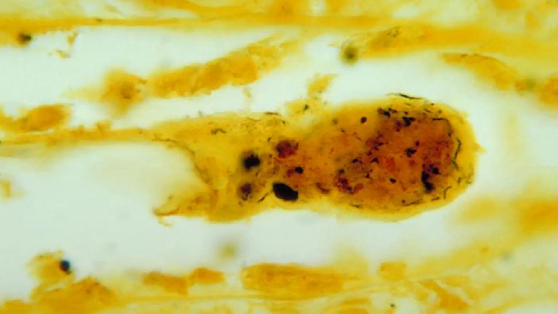 Muestra de tejido renal que muestra la bacteria que causa leptospirosis