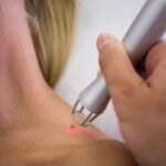 Una vacuna experimental logra la remisión del cáncer de piel en personas con melanoma de alto riesgo