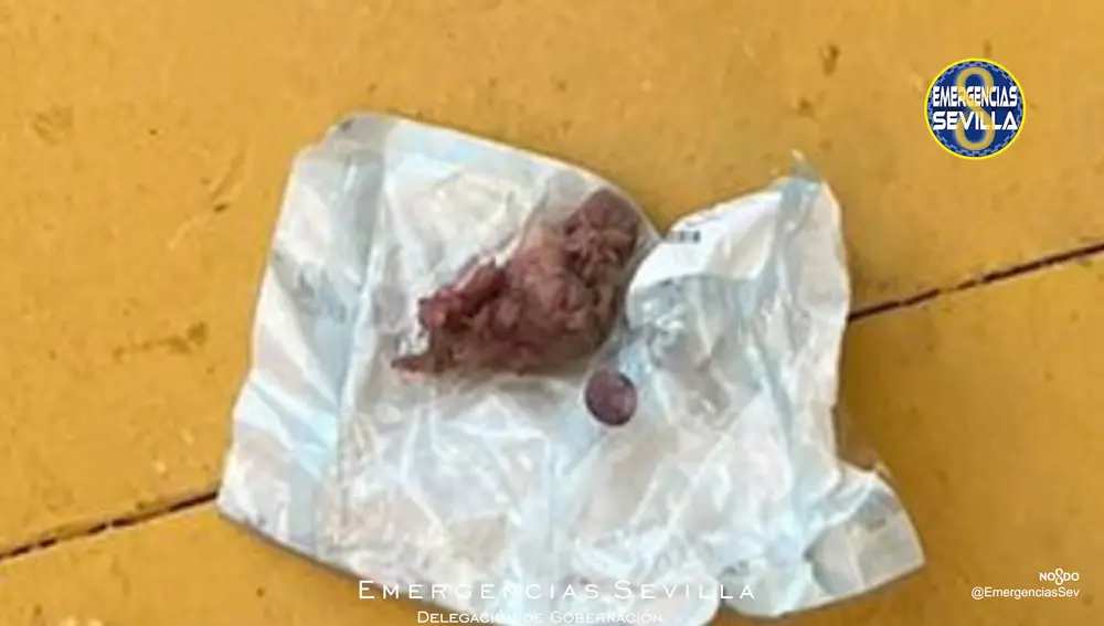El trozo de carne del atragantamiento