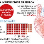 Insuficiencia cardiaca