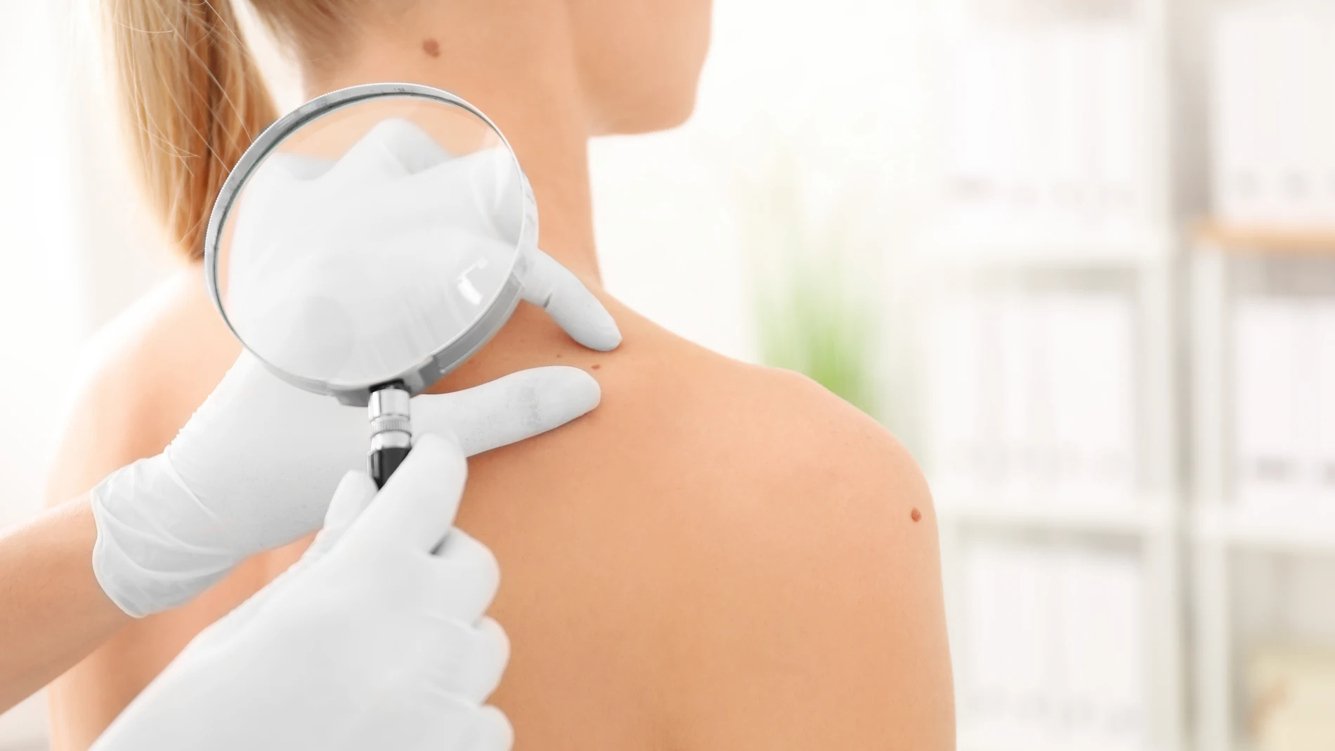 Melanoma en gente joven