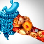 Problemas digestivos a causa de la alimentción