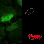 La imagen ilustra la ubicación del daño en el ADN (en el núcleo de estas cuatro células, verde) y la colocalización de PRDX1 (en rojo, en el mismo lugar). 