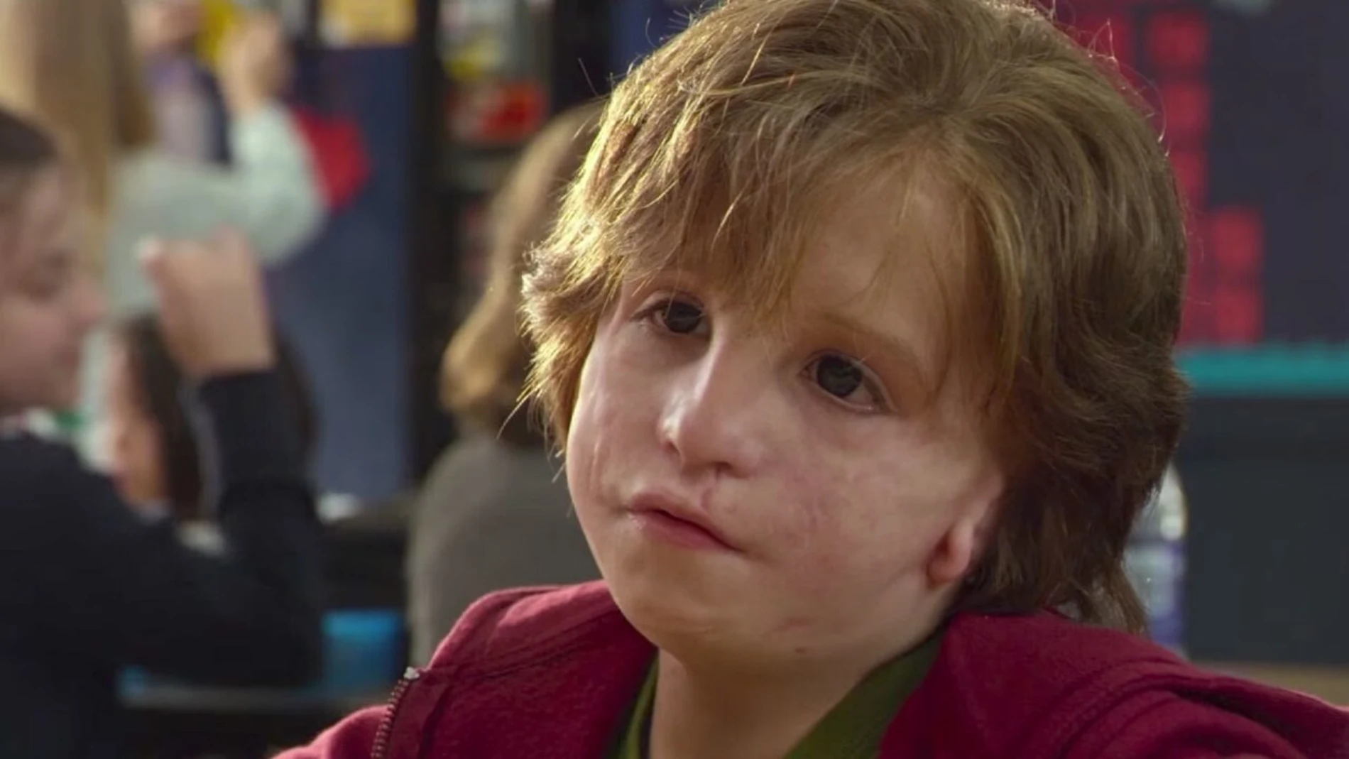 Tal y como pudimos apreciar en la película 'Wonder', los niños pueden verse afectados psicológicamente debido al rechazo de los demás por su aspecto física