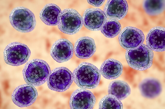 Linfoma