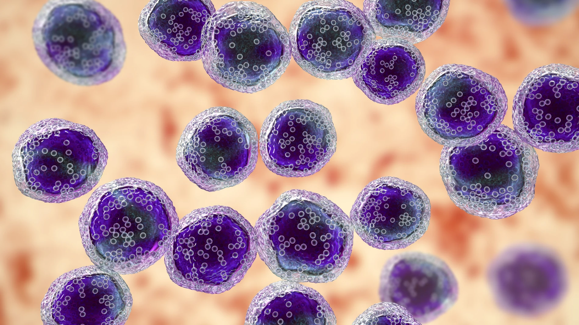 Linfoma