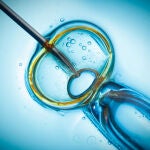 Imagen aguja y célula : fábrica de humanos