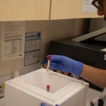 Un investigador manipula muestras de pacientes con déficit de DOCK11