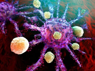 C&eacute;lulas cancer&iacute;genas c&aacute;ncer